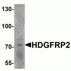 HRP-2 Antibody - BSA Free, Novus Biologicals 0.1 mg; Unconjugated:Antibodies,