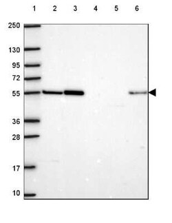 HS3ST3A1 Antibody, Novus Biologicals 25 &mu;L, Unconjugated:Antibodies,