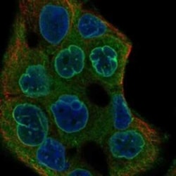 HS747E2A Rabbit anti-Human, Polyclonal, Novus Biologicals 100 &mu;g; Unconjugated:Antibodies,