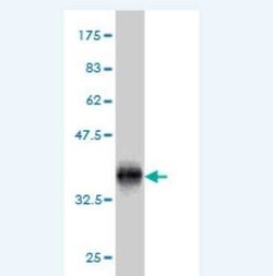 HSBP1 Antibody (2C3), Novus Biologicals 0.1 mg | Buy Online | Novus Biologicals | Fisher Scientific