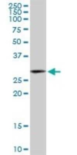 HSD17B12 Antibody (4G11), Novus Biologicals 0.1 mg | Buy Online | Novus Biologicals | Fisher Scientific
