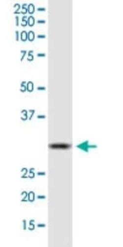 HSD17B12 Antibody (4G11), Novus Biologicals 0.1 mg | Buy Online | Novus Biologicals | Fisher Scientific