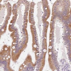 HSD17B2 Antibody, Novus Biologicals 25 &mu;L, Unconjugated:Antibodies,