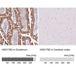 HSD17B2 Antibody, Novus Biologicals 25 &mu;L, Unconjugated:Antibodies,