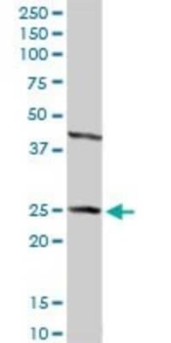 HSD17B2 Antibody, Novus Biologicals 0.1 mg | Buy Online | Novus Biologicals | Fisher Scientific