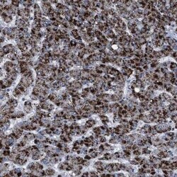 HSD17B4 Antibody, Novus Biologicals 0.1 mL | Buy Online | Novus Biologicals | Fisher Scientific