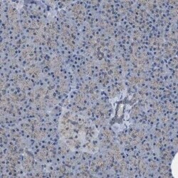 HSD17B4 Antibody, Novus Biologicals 0.1 mL | Buy Online | Novus Biologicals | Fisher Scientific