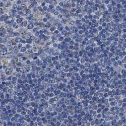 HSD17B4 Antibody, Novus Biologicals 0.1 mL | Buy Online | Novus Biologicals | Fisher Scientific