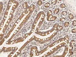 HSD17B4 Antibody, Novus Biologicals:Antibodies:Primary Antibodies