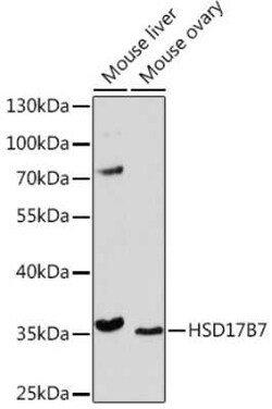 HSD17B7 Rabbit anti-Human, Mouse, Polyclonal, Novus Biologicals 20 &mu;g;