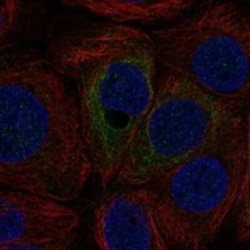 HSD29 Rabbit anti-Human, Polyclonal, Novus Biologicals 100 &mu;g | Buy Online | Novus Biologicals | Fisher Scientific