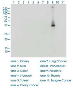 HSD3B1 Antibody (3C11-D4), Novus Biologicals 0.1 mg | Buy Online | Novus Biologicals | Fisher Scientific