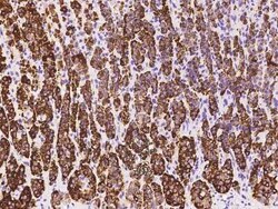 HSD3B1 Antibody, Novus Biologicals:Antibodies:Primary Antibodies