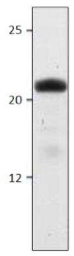 HSD5 Antibody, Novus Biologicals 100 &mu;g | Buy Online | Novus Biologicals | Fisher Scientific