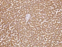 HSDL2 Antibody, Novus Biologicals:Antibodies:Primary Antibodies