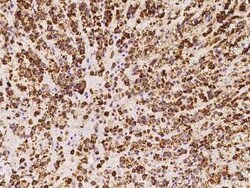 HSDL2 Antibody, Novus Biologicals:Antibodies:Primary Antibodies