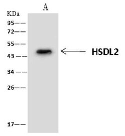 HSDL2 Antibody, Novus Biologicals:Antibodies:Primary Antibodies