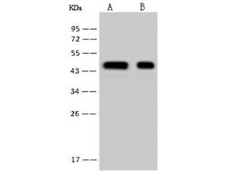 HSDL2 Antibody, Novus Biologicals:Antibodies:Primary Antibodies