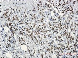 HSF1 Rabbit anti-Human, Clone: S07-0G0, Novus Biologicals 25 &mu;g; Unconjugated:Antibodies,