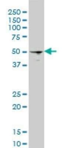 HSF4 Antibody (1A4), Novus Biologicals 0.1 mg | Buy Online | Novus Biologicals | Fisher Scientific