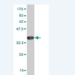 HSF4 Antibody (2B3), Novus Biologicals 0.1 mg | Buy Online | Novus Biologicals | Fisher Scientific
