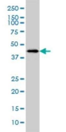 HSFX1/2 Antibody (1D7), Novus Biologicals 0.1 mg | Buy Online | Novus Biologicals | Fisher Scientific