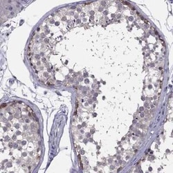 HSFX2 Antibody, Novus Biologicals 25ul; Unconjugated:Antibodies, Polyclonal