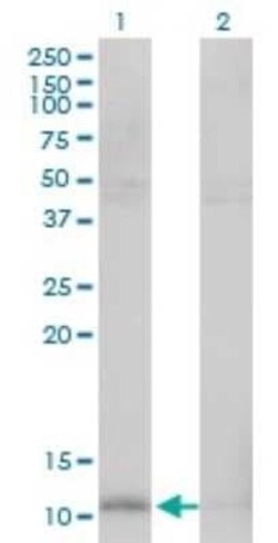 HSP10/EPF Antibody (4C11-B11), Novus Biologicals 0.1 mg | Buy Online | Novus Biologicals | Fisher Scientific