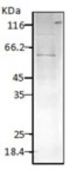 HSP60 Antibody, Novus Biologicals 0.025 mg; Unconjugated:Antibodies, Polyclonal