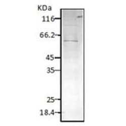 HSP60 Antibody, Novus Biologicals 0.025 mg; Unconjugated:Antibodies, Polyclonal