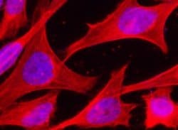 HSP70/HSPA1A Rabbit anti-Human, Clone: 1, Novus Biologicals 100 &mu;g;