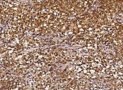 HSP70/HSPA1A Rabbit anti-Human, Clone: 1, Novus Biologicals 100 &mu;g;