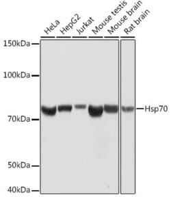 HSP70/HSPA1A Rabbit anti-Human, Mouse, Rat, Clone: 5U9A0, Novus Biologicals 20 &mu;g | Buy Online | Novus Biologicals | Fisher Scientific