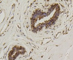 HSP70/HSPA1A Rabbit anti-Human, Clone: SA0379, Novus Biologicals 100&mu;L:Antibodies,