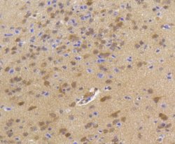 HSP70/HSPA1A Rabbit anti-Human, Clone: SA0379, Novus Biologicals 100&mu;L:Antibodies,