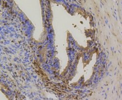 HSP70/HSPA1A Rabbit anti-Human, Clone: SA0379, Novus Biologicals 100&mu;L:Antibodies,