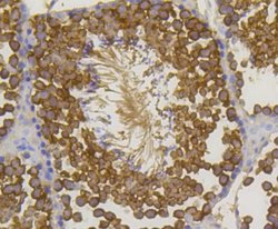 HSP70/HSPA1A Rabbit anti-Human, Clone: SA0379, Novus Biologicals 100&mu;L:Antibodies,
