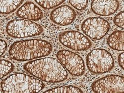 HSP70/HSPA1A, ac Lys77 Antibody, Novus Biologicals 100&mu;L:Antibodies,