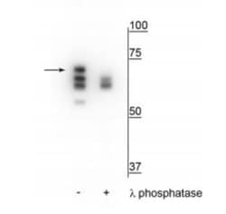 HSP70/HSPA1A, p Ser153 Antibody, Novus Biologicals 100&mu;L:Antibodies,