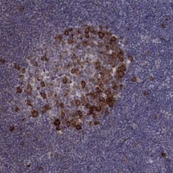 HSP90 beta Antibody, Novus Biologicals 25ul; Unconjugated:Antibodies, Polyclonal