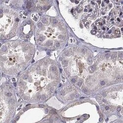 HSP90 beta Antibody, Novus Biologicals 25ul; Unconjugated:Antibodies, Polyclonal