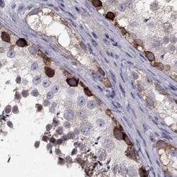 HSP90 beta Antibody, Novus Biologicals 25ul; Unconjugated:Antibodies, Polyclonal