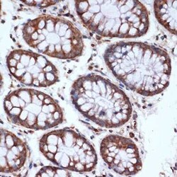 HSPA14 Rabbit anti-Human, Mouse, Clone: 4L1Z6, Novus Biologicals 20 &mu;g;