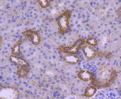 HSPA14 Rabbit anti-Human, Clone: SD08-48, Novus Biologicals 100&mu;L:Antibodies,