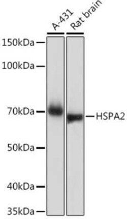 HSPA2 Rabbit anti-Human, Mouse, Rat, Clone: 5C9X0, Novus Biologicals:Antibodies:Primary