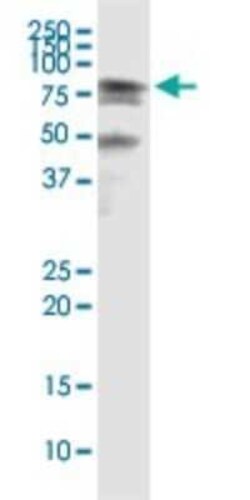 HSPA2 Antibody (2D11), Novus Biologicals 0.1 mg | Buy Online | Novus Biologicals | Fisher Scientific