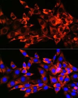 HSPB8/HSP22 Rabbit anti-Human, Mouse, Rat, Clone: 3K10W1, Novus Biologicals:Antibodies:Primary