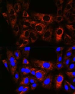 HSPB8/HSP22 Rabbit anti-Human, Mouse, Rat, Clone: 3K10W1, Novus Biologicals:Antibodies:Primary