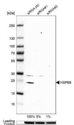 HSPB8/HSP22 Antibody, Novus Biologicals 0.1 mL; Unconjugated:Antibodies,