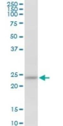 HSPC111 Antibody, Novus Biologicals 0.05 mg | Buy Online | Novus Biologicals | Fisher Scientific